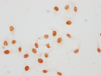 HIST1H1E Antibody