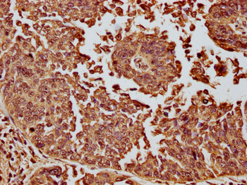H1F0 Antibody