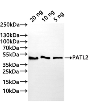 PATL2 Antibody