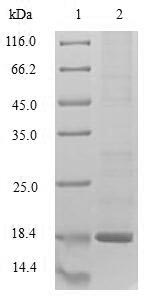 Recombinant Rabbit Histidine triad nucleotide-binding protein 1 (HINT1)