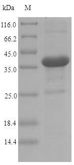 Bacterial Invasin protein