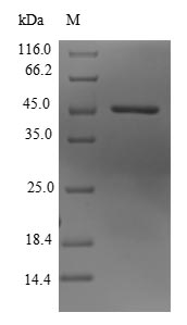 Human KDM3B protein