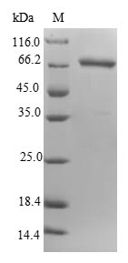 E. coli ygiS protein