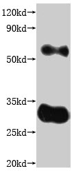 Human CLDN18.2 protein
