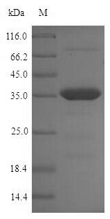 Bacterial omcB protein