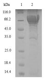 Human PAH protein