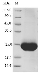 Human CXCR4 protein