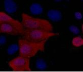 His Tag (2A2) Mouse mAb Antibody