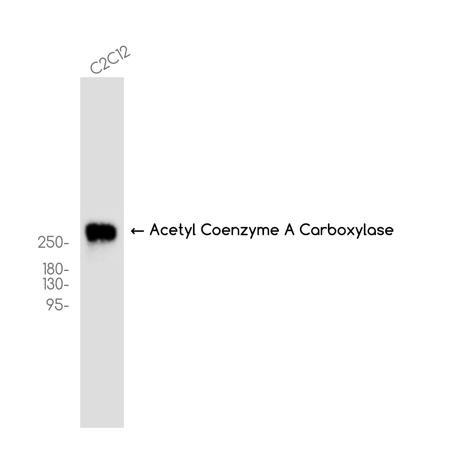 Acetyl Coenzyme A Carboxylase Rabbit mAb