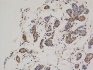 Bcl2 (3H5) Mouse mAb