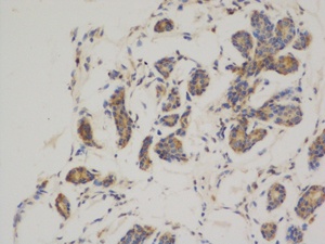 BCL2 Antibody