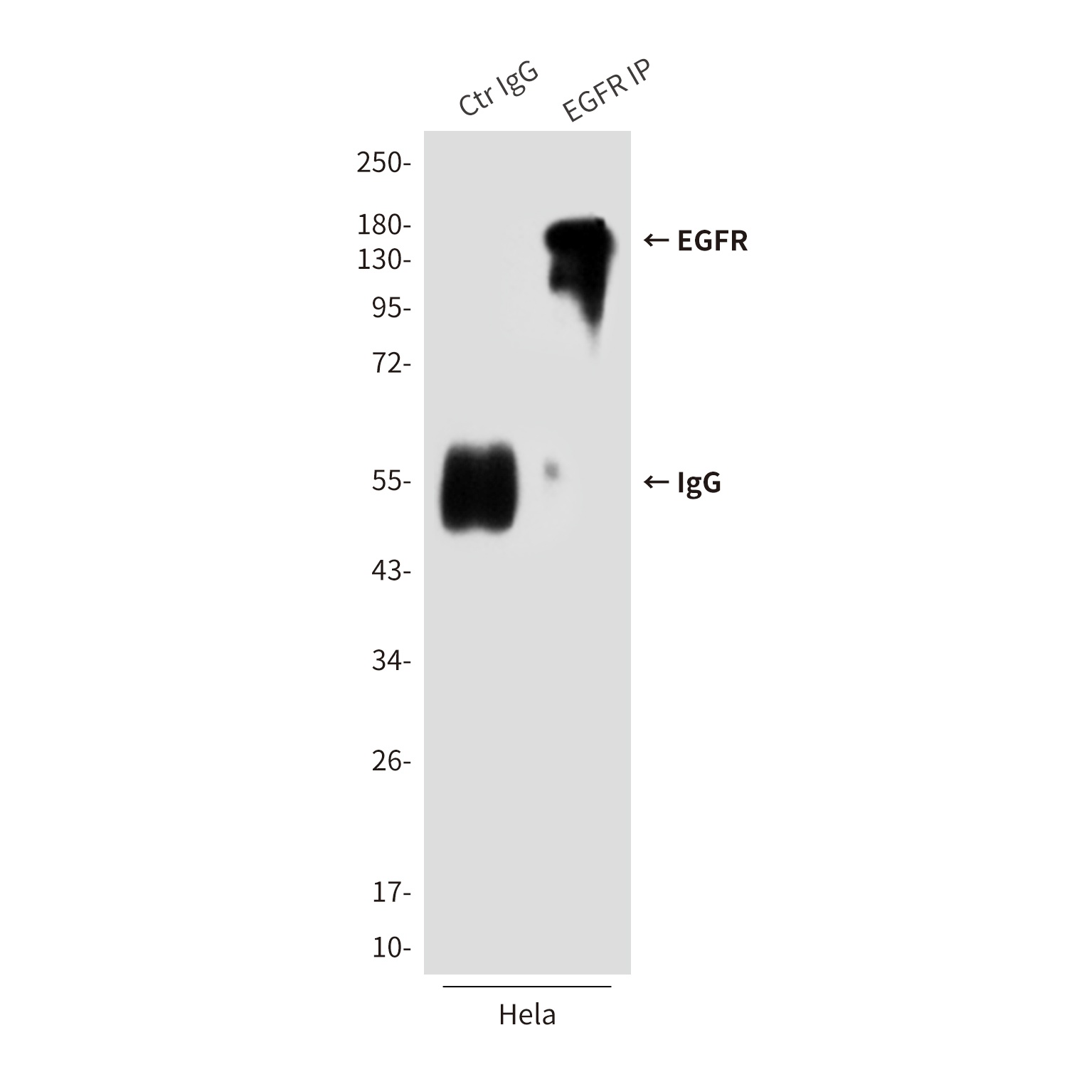 EGFR (6H11) Mouse mAb