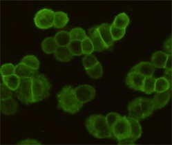 EGFR (6H11) Mouse mAb