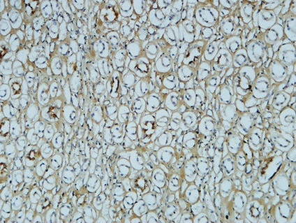 Fibronectin (1E2) Mouse mAb