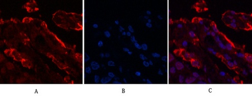 Galectin 3 (4B2) Mouse mAb
