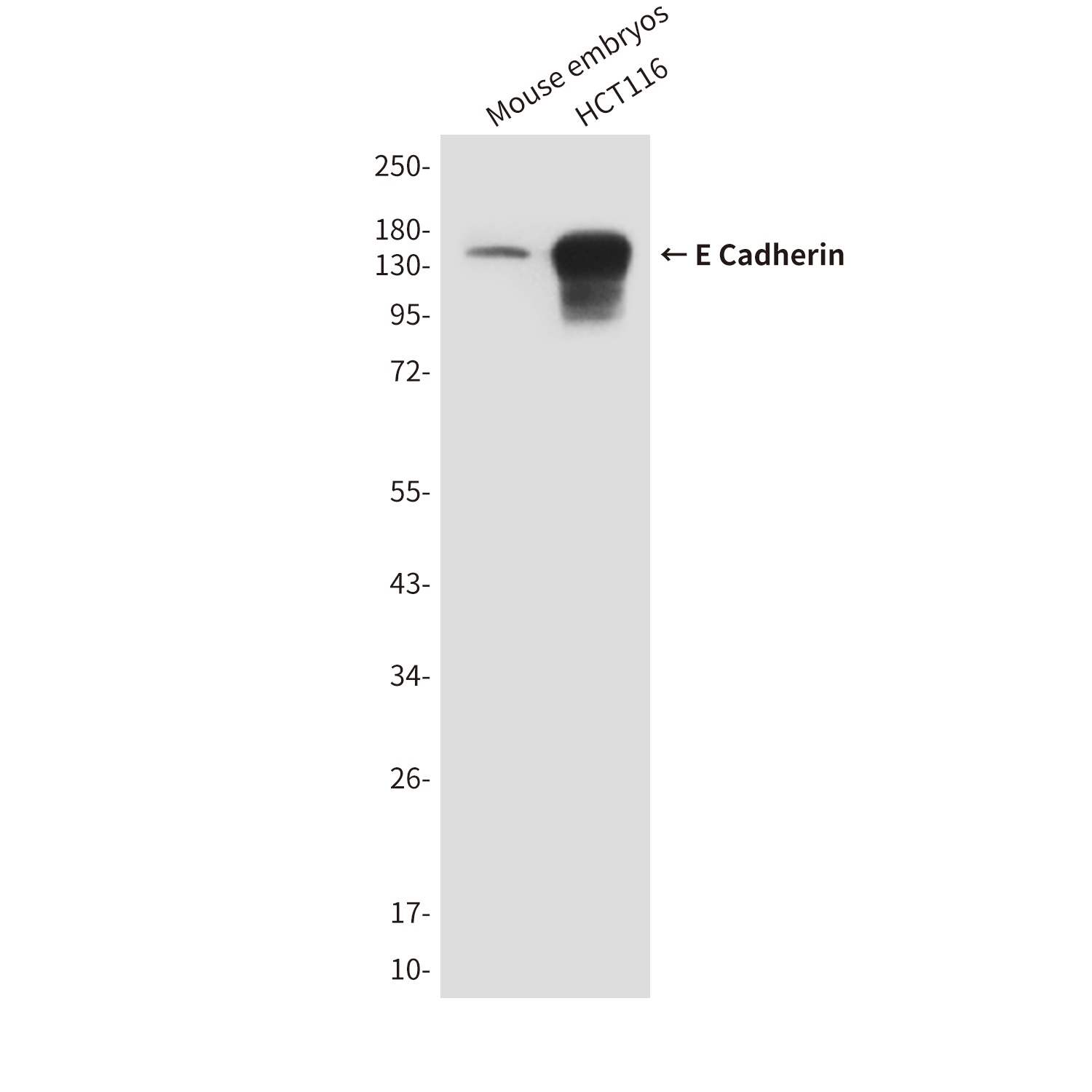 E Cadherin (6B10) Mouse mAb