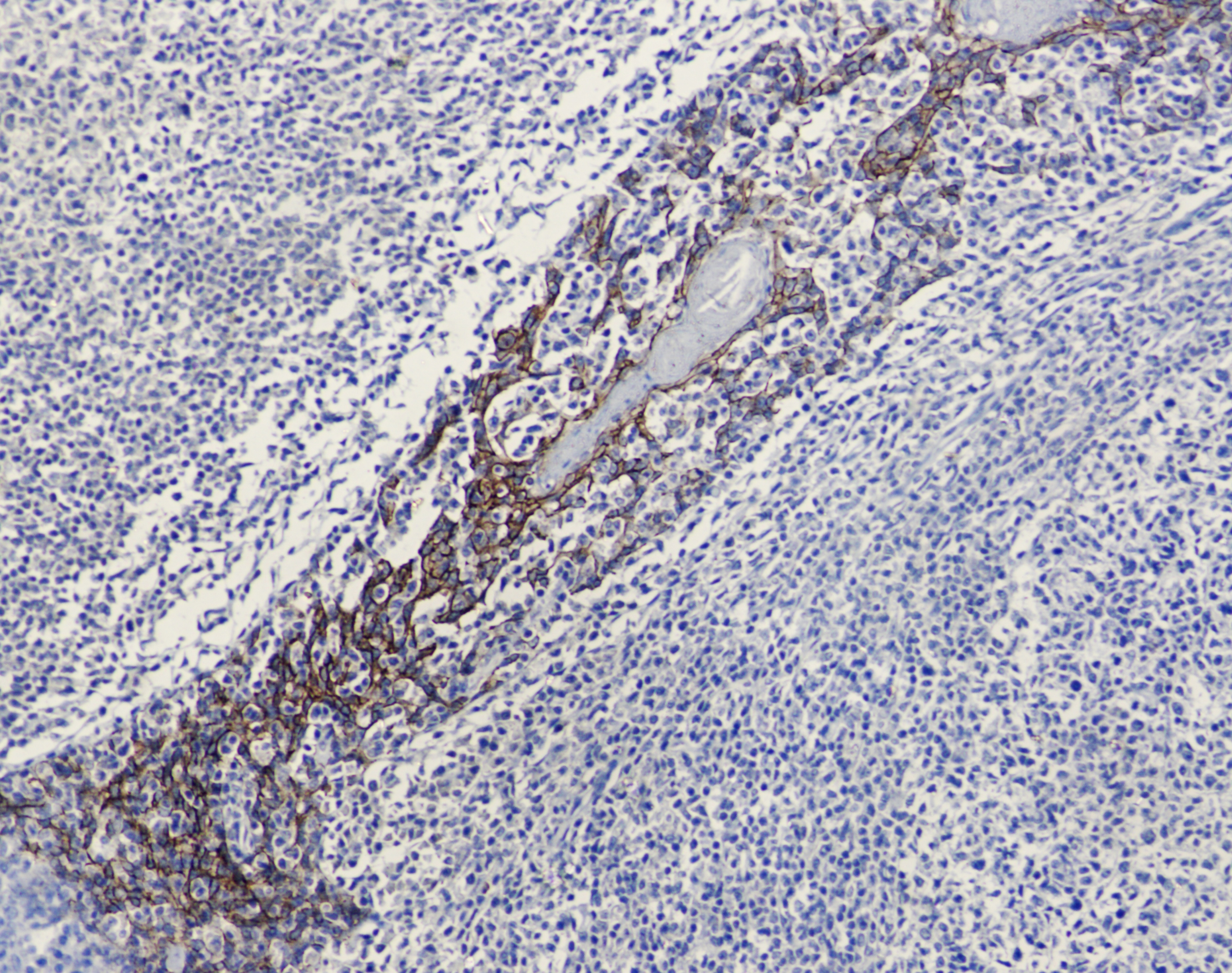 E Cadherin (6B10) Mouse mAb