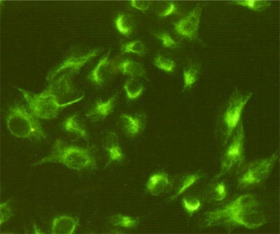 Vimentin (4F8) Mouse mAb