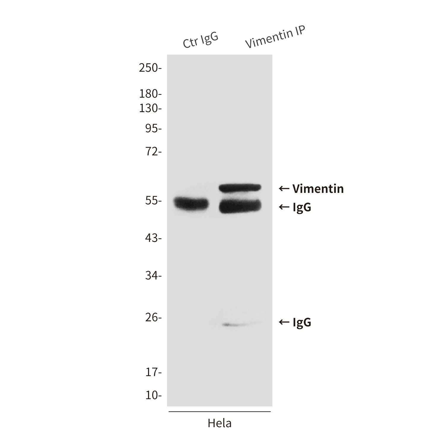 Vimentin (4F8) Mouse mAb