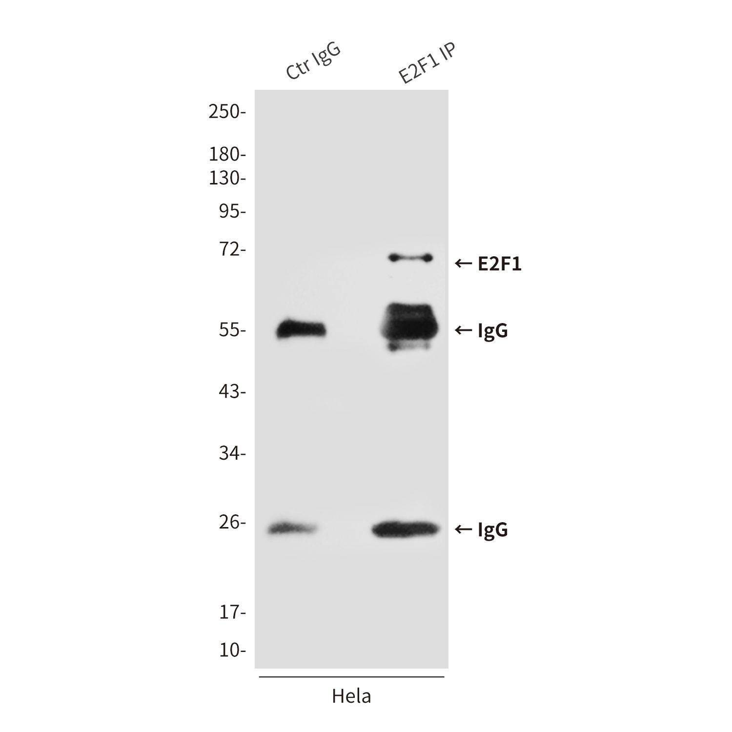 E2F1 Antibody
