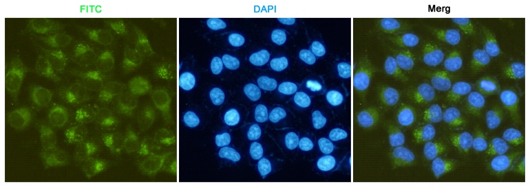 MMP2 (3A8) Mouse mAb