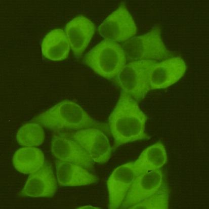 Fatty Acid Synthase (2F9) Mouse mAb