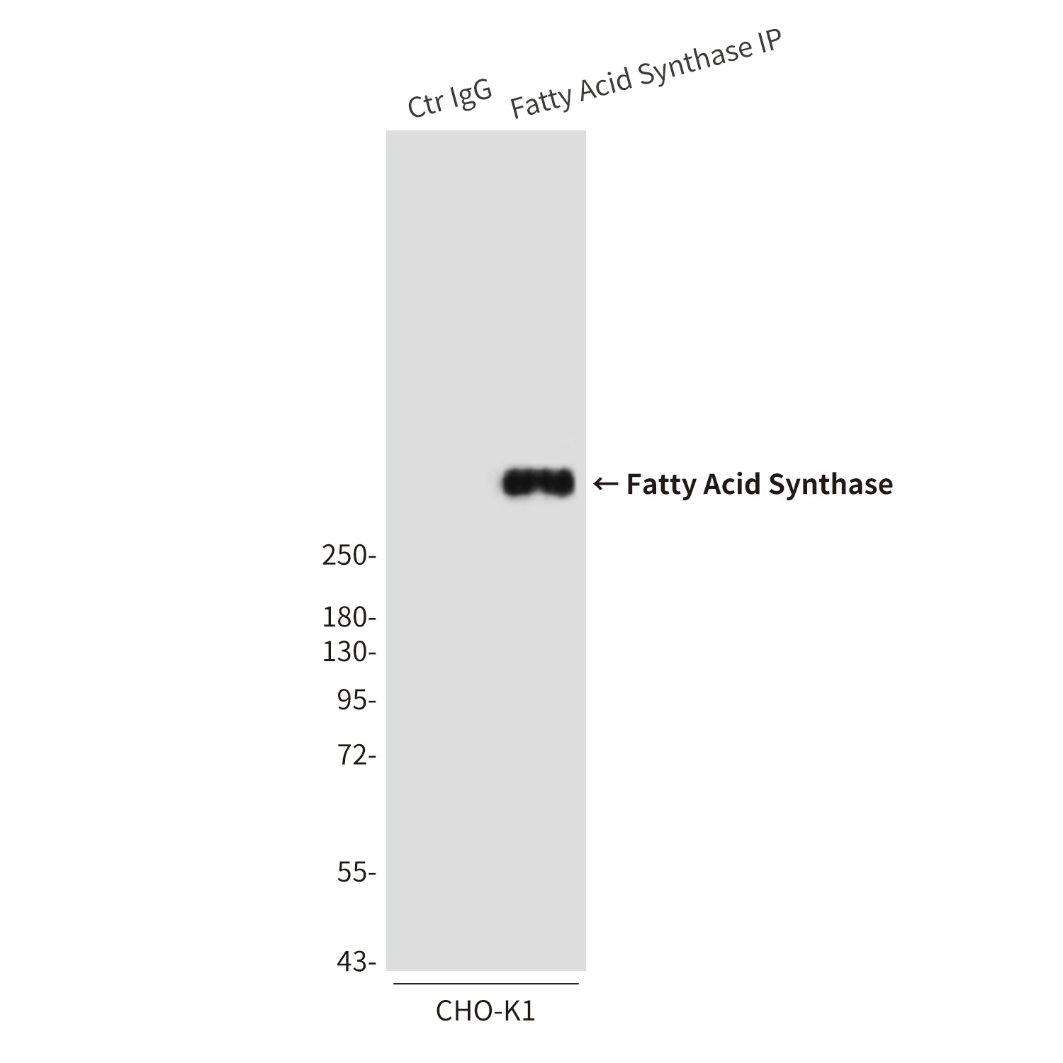 Fatty Acid Synthase (2F9) Mouse mAb