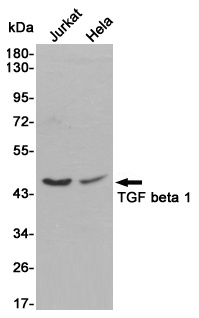 TGFB1 Antibody