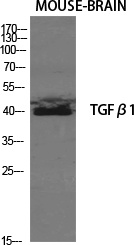 TGFB1 Antibody
