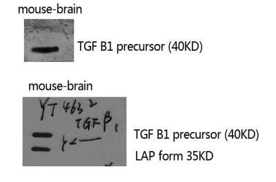 TGFB1 Antibody