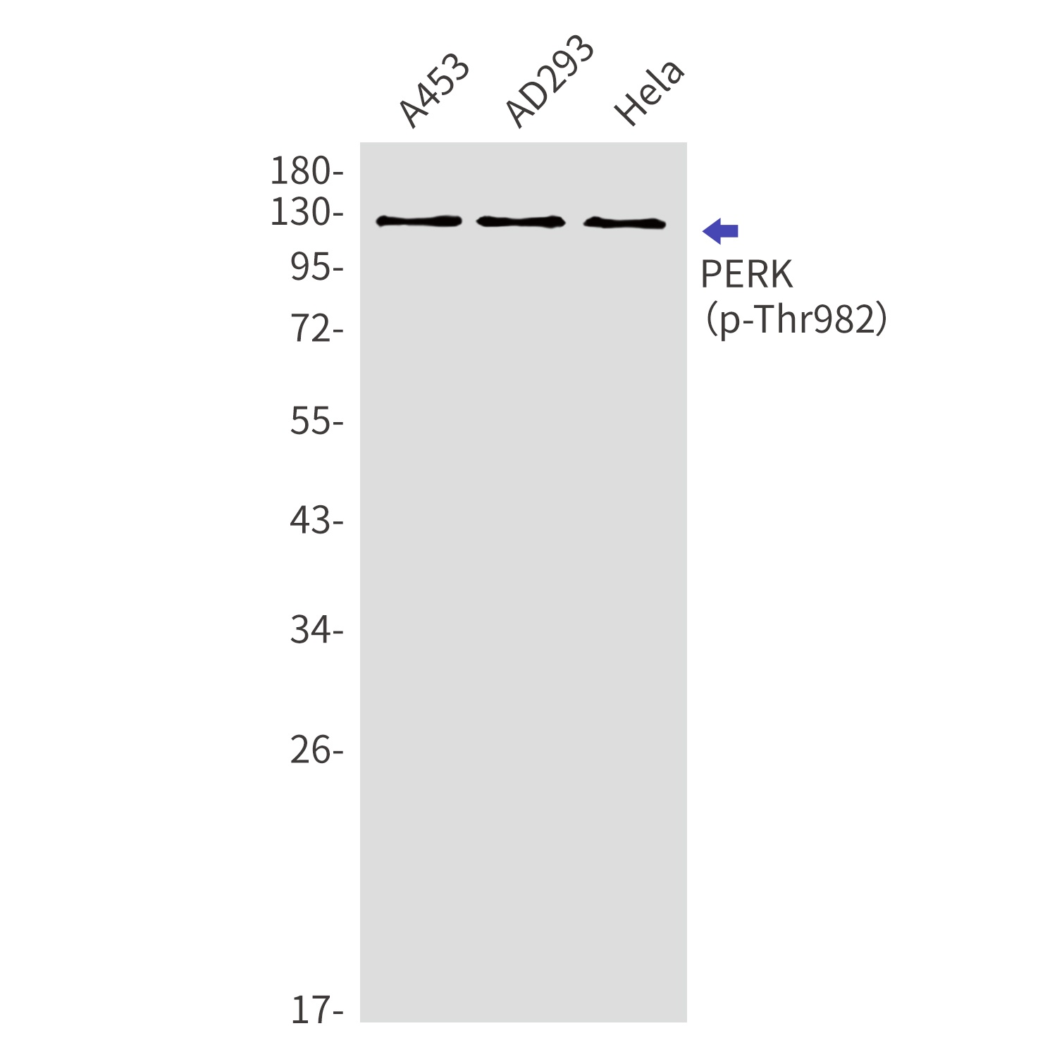 Phospho-PERK (Thr982) Rabbit pAb
