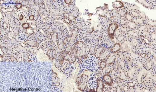Phospho-PERK (Thr982) Rabbit pAb
