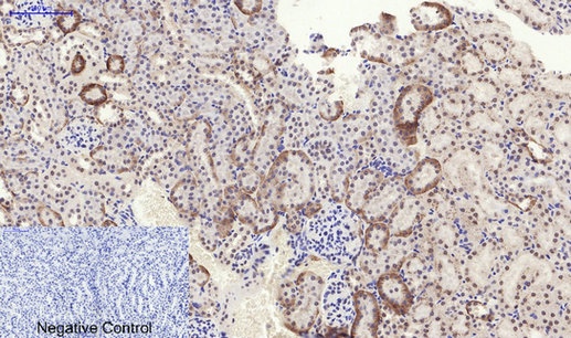 EIF2AK3 Antibody