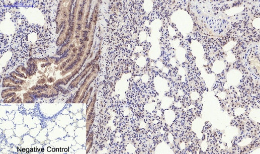 Phospho-PERK (Thr982) Rabbit pAb