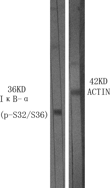 NFKBIA Antibody