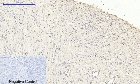 NOS2 Antibody