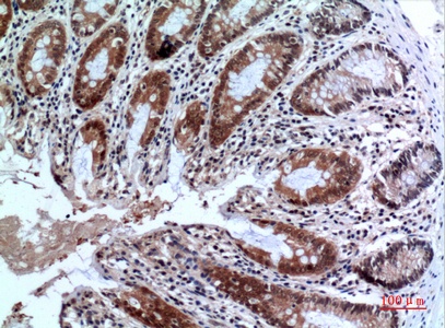 FOXP3 Antibody