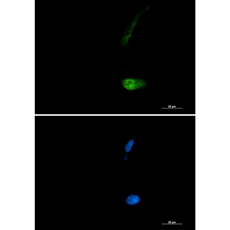 SQSTM1 Antibody