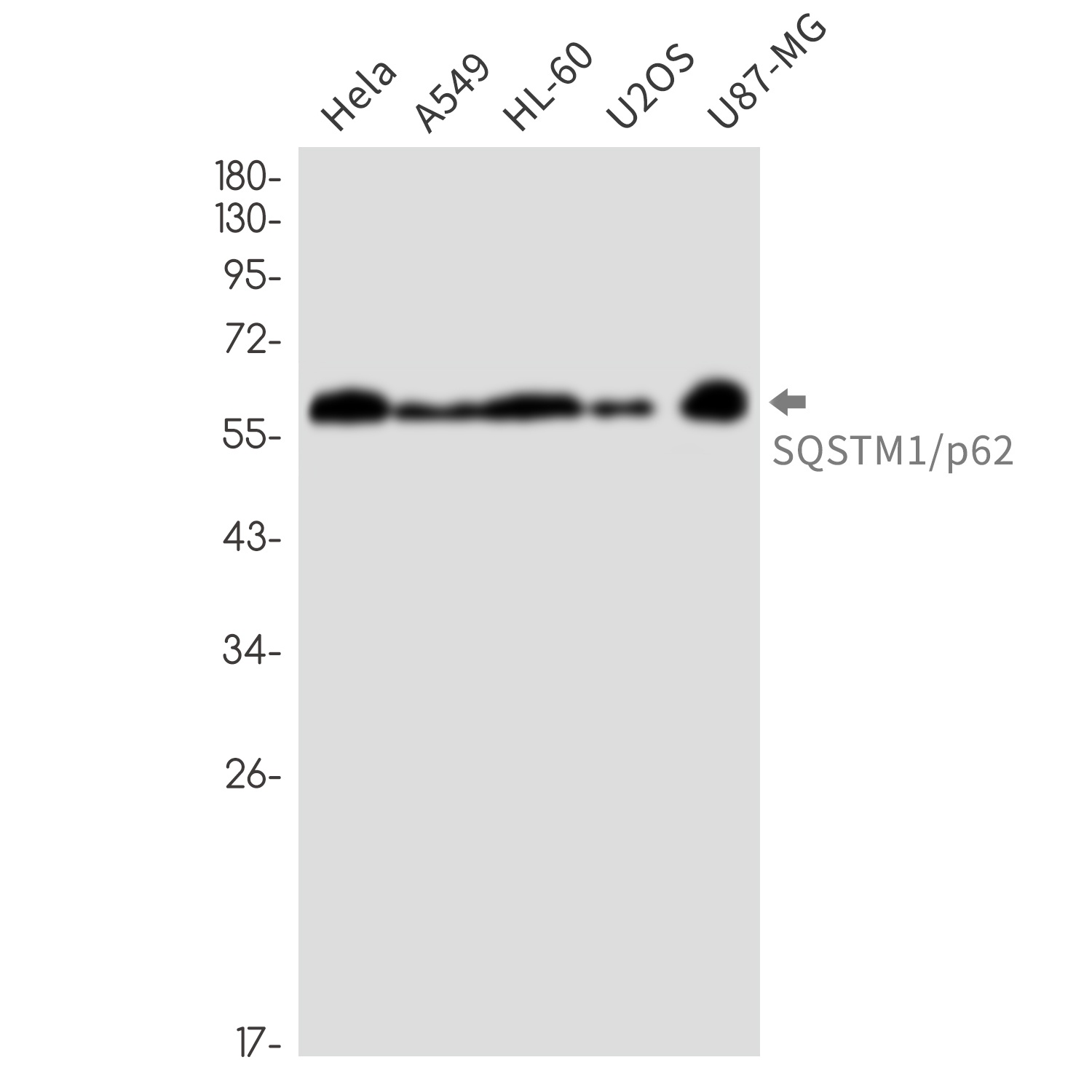 SQSTM1 Antibody
