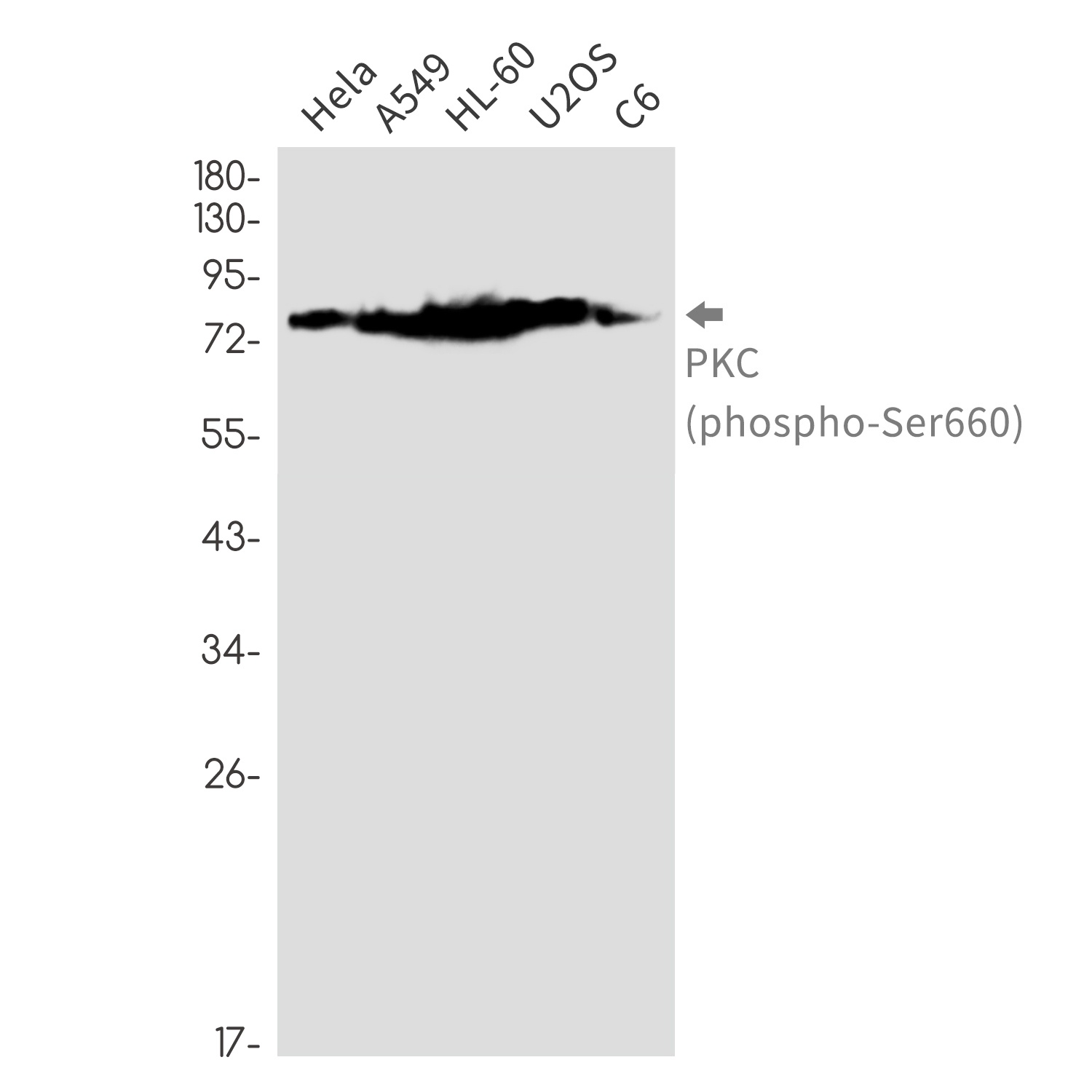 Phospho-PKC (Ser660) Rabbit mAb