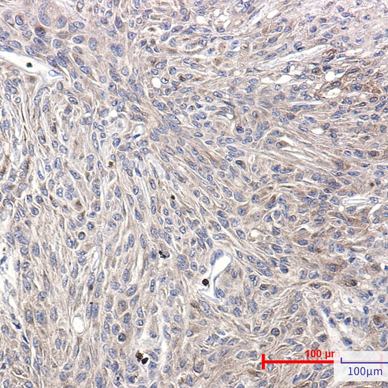 Phospho-PKC (Ser660) Rabbit mAb