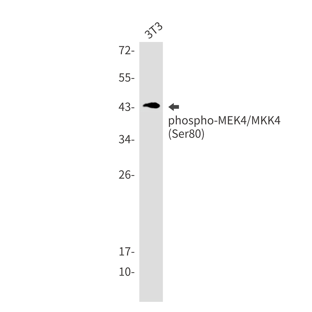 Phospho-MEK4 (Ser80) Rabbit mAb