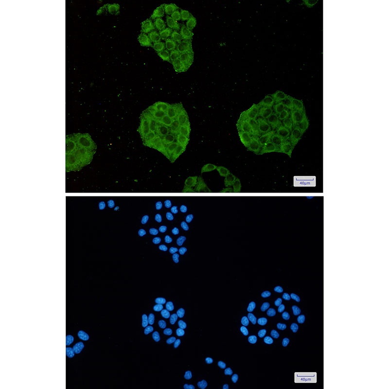TRIM56 Rabbit mAb