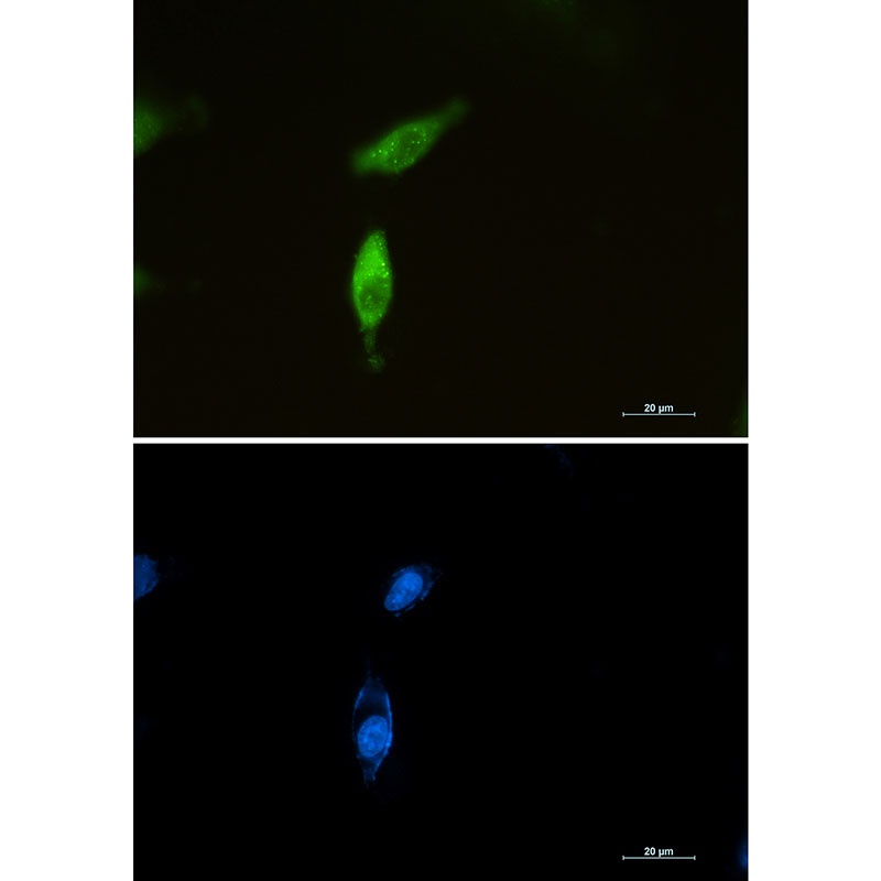 SQSTM1 Antibody