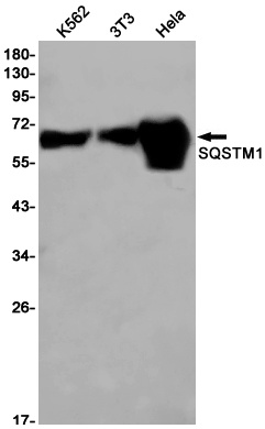 SQSTM1 Antibody