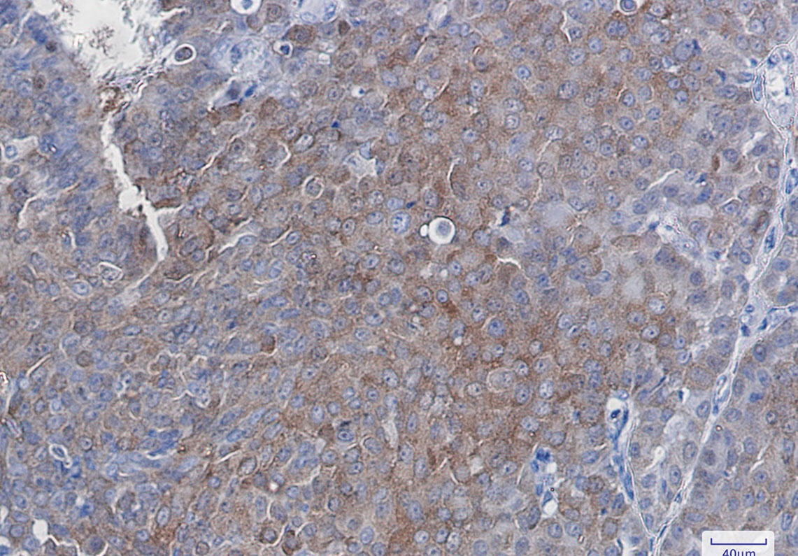 SQSTM1 Antibody