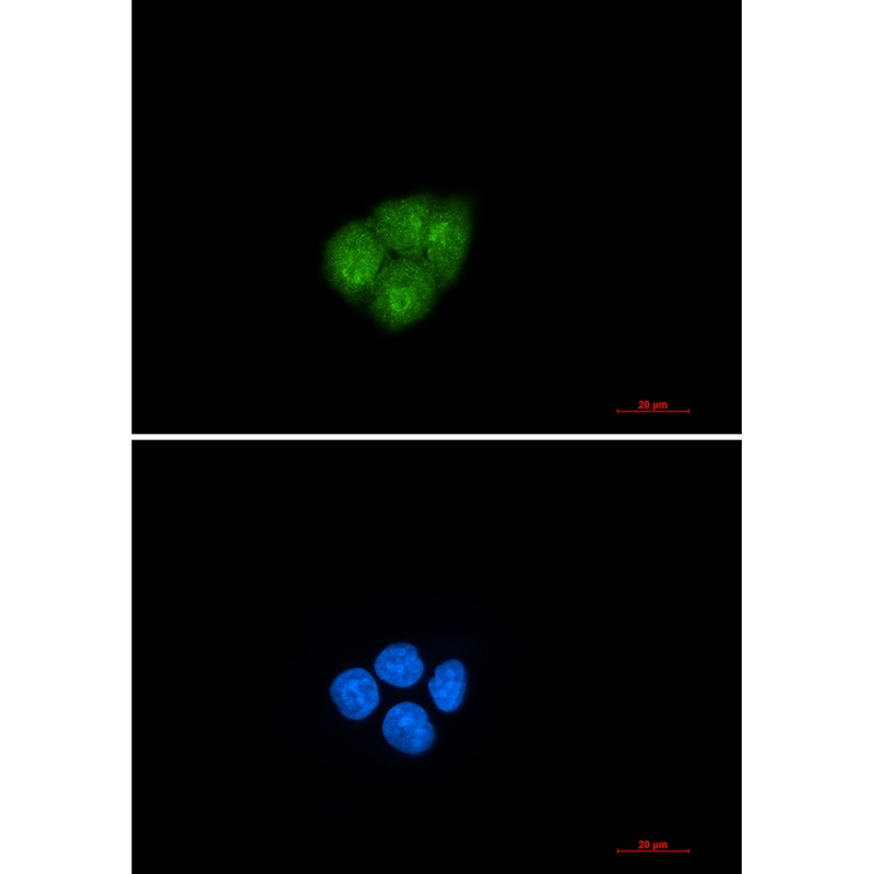 SMAD2 Antibody