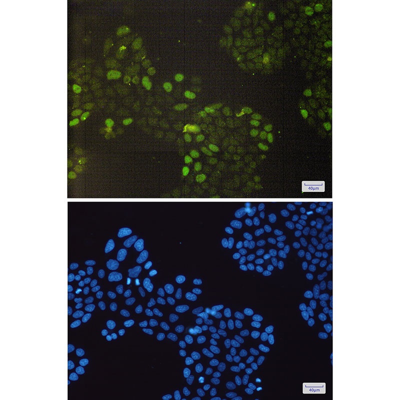 RB1 Antibody