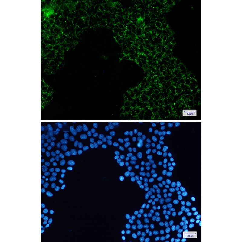 PDHA1 Antibody