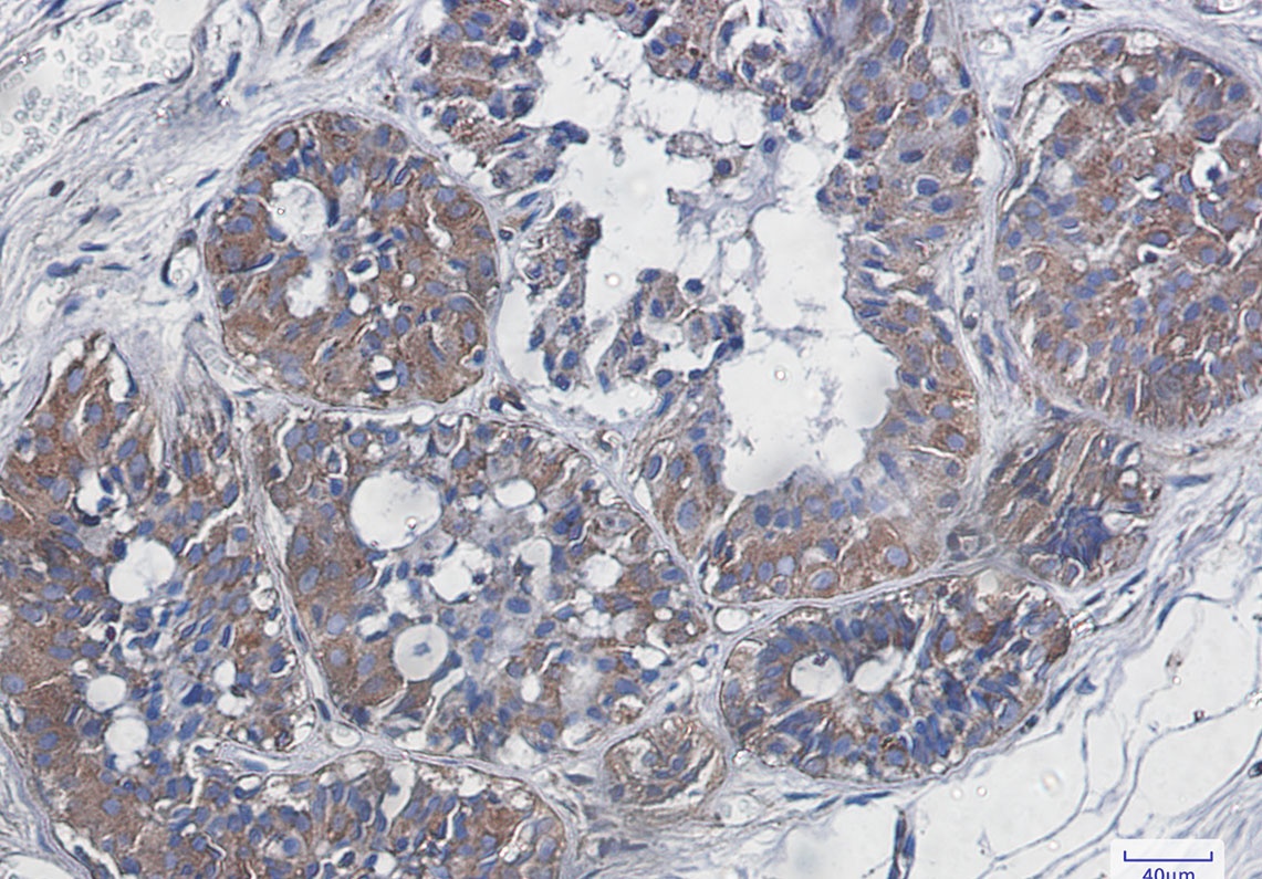 RELA Antibody
